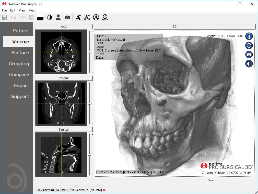 ProSurgical3D - Created by PostDICOM